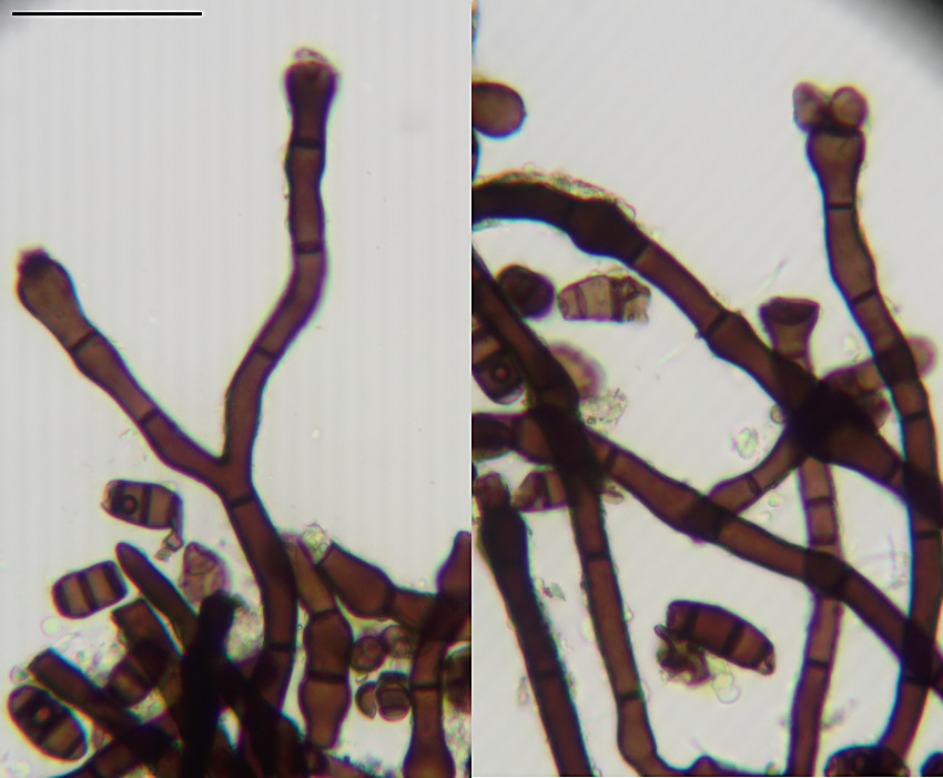Chaetosphaerella fusca