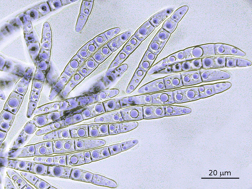 Leptosphaeria maculans