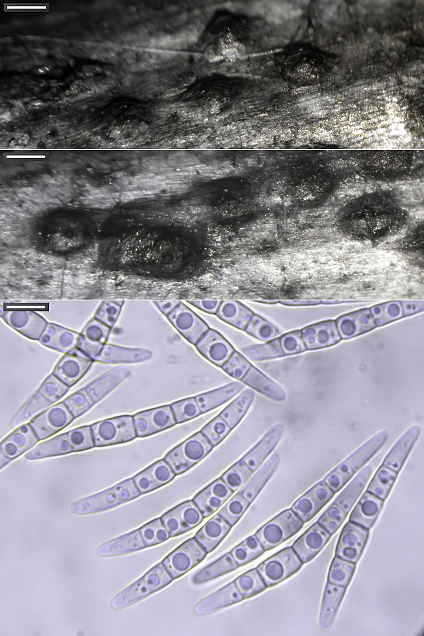 Leptosphaeria maculans