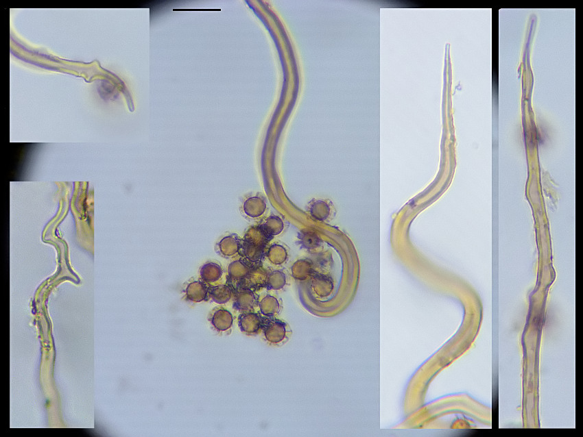 Myriostoma coliforme