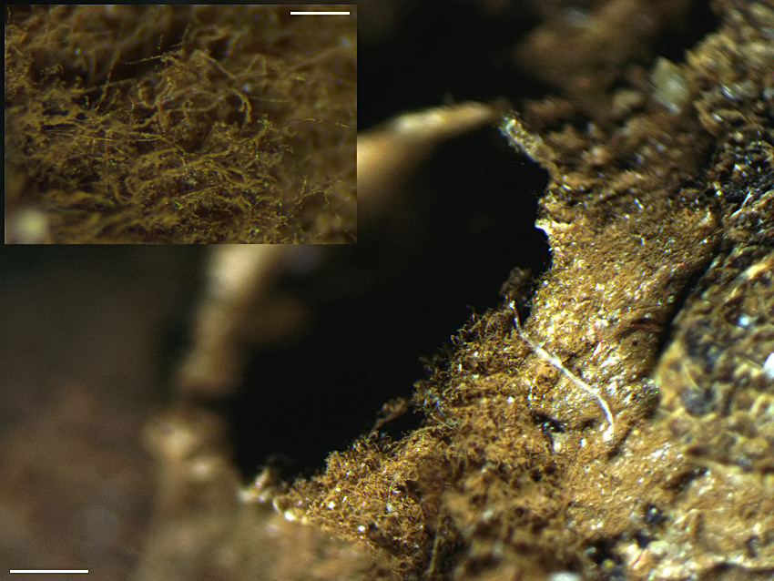 Myriostoma coliforme